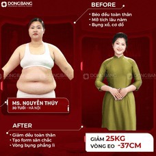 Giảm béo Liệu pháp cao
